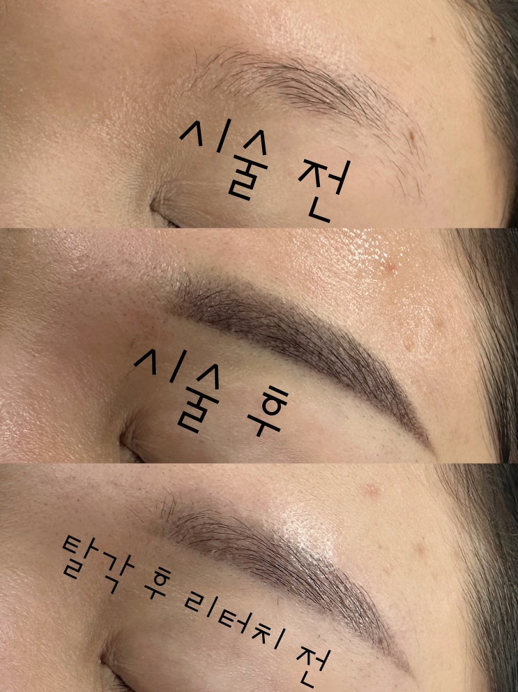  천안 눈썹문신, 잘 알아보고 똑똑하게 받으세요!