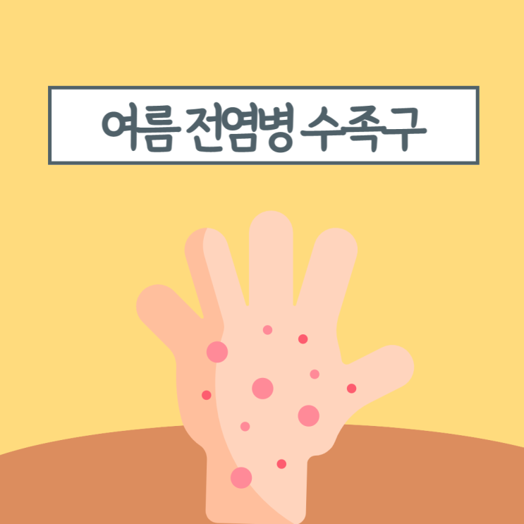  여름 전염병 수족구병 어린이집 등원해도 될까? 아기 어린이 수족구 증상과 치료 예방방법
