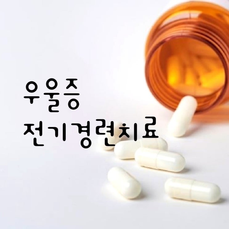 <b>우울증</b> 약물<b>치료</b> 대신 전기경련<b>치료</b>(전기충격<b>치료</b>ECT)