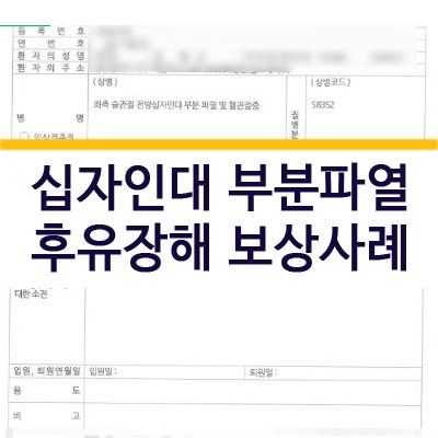 전,후방 십자인대 부분파열도 후유장해가 남습니다