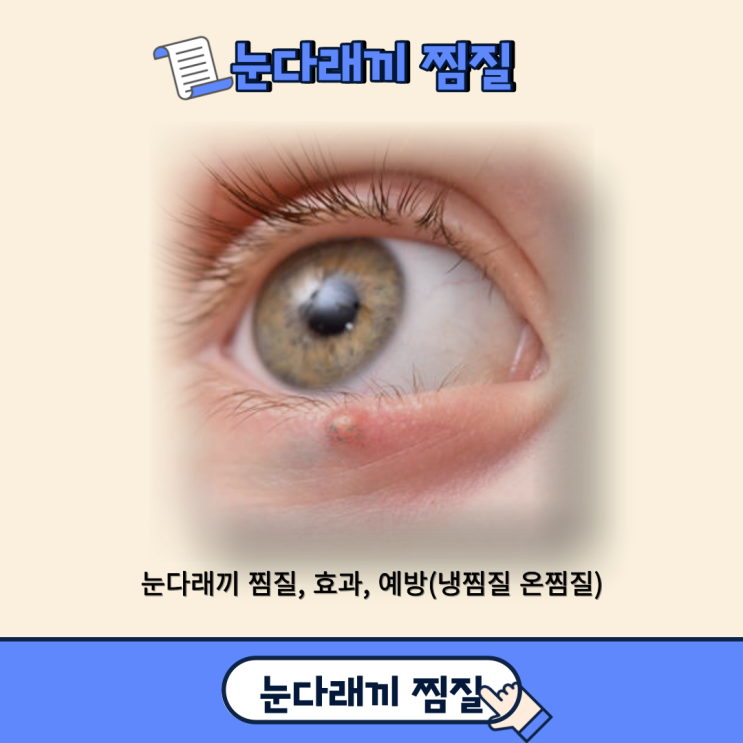  눈다래끼 찜질, 효과, 예방(냉찜질 온찜질)