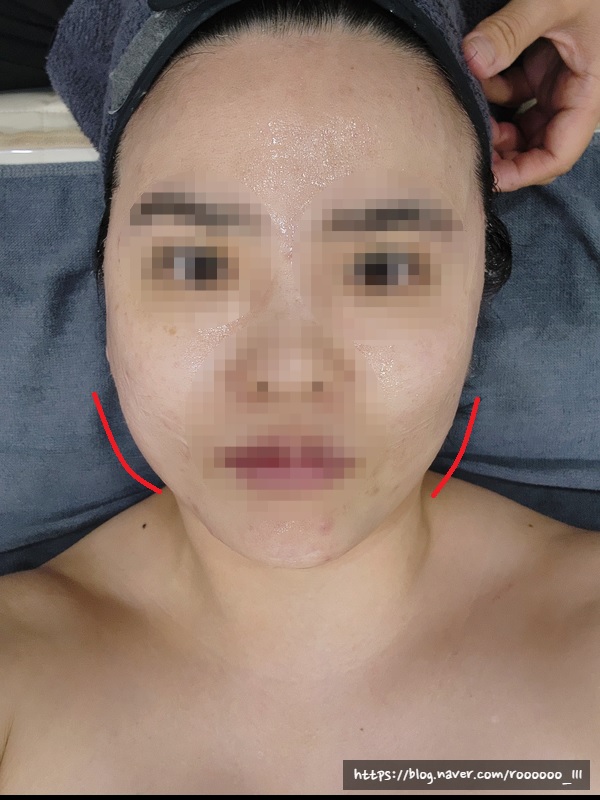 예신 물광피부갖기 대작전 "리타임뷰티 향남점"
