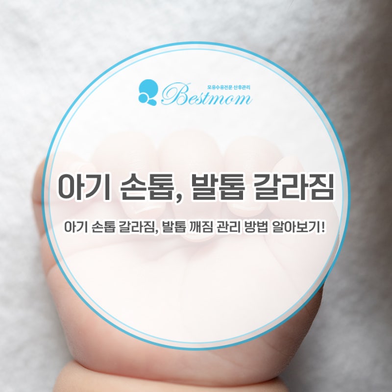 아기 손톱 갈라짐, 발톱 깨짐 관리 방법 알아보기!