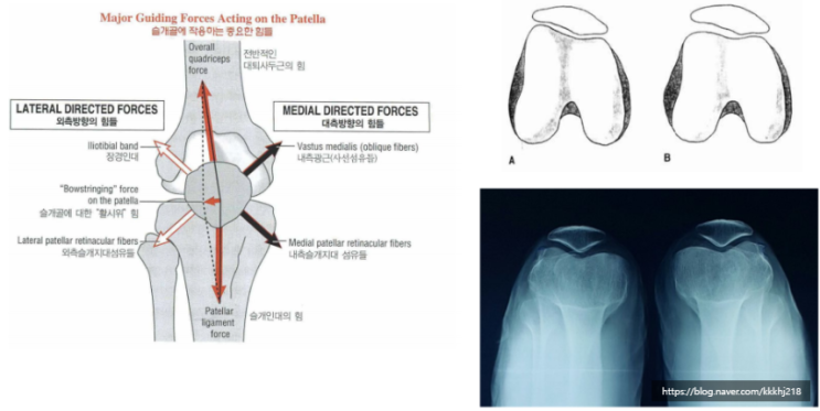 무릎뼈의 필요성과 무릎뼈의 변화
