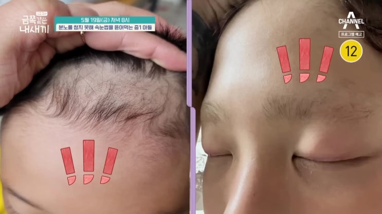 분노조절 중1 아들 금쪽이 눈썹 머리 뜯어 먹고 할머니에게 폭언 정서의 그릇 마음의 그릇 요즘육아 금쪽같은 내새끼 147회 분노조절 중1 아들 금쪽이 눈썹 머리 뜯어 먹고 할머니에게 폭언 정서의 그릇 마음의 그릇 요즘육아 금쪽같은 내새끼 147회