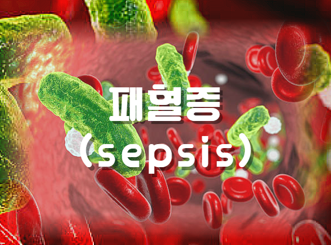 [생리학]  패혈증(sepsis)의 단계와 특성