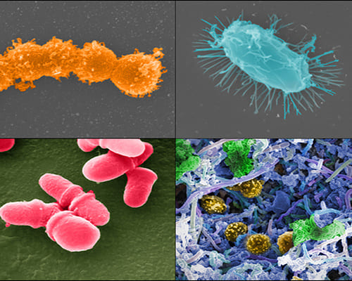 100세 사는 사람들의 몸 속은 특별하다?Viruses in the guts of centenarians may help them resist pathogens