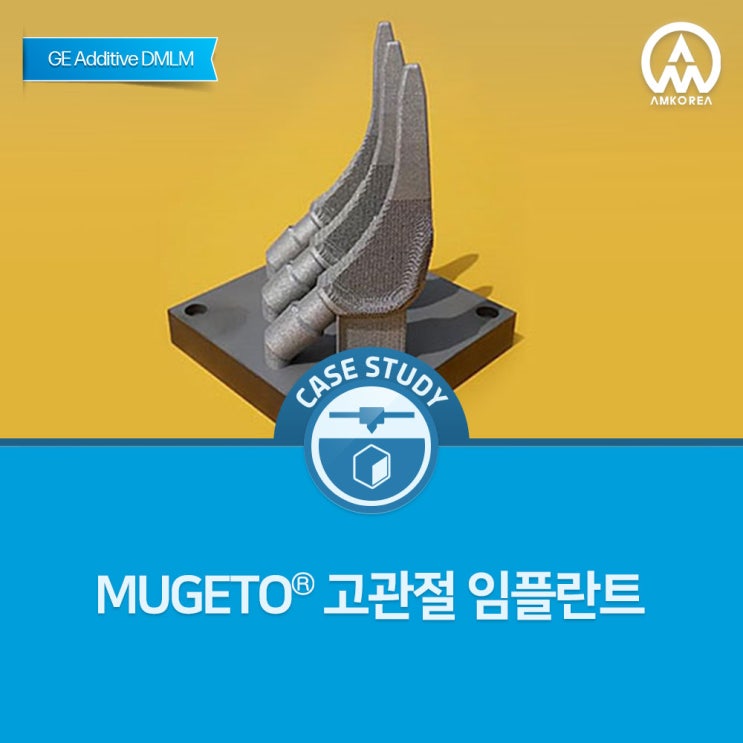  [GE Additive] MUGETO 고관절 임플란트