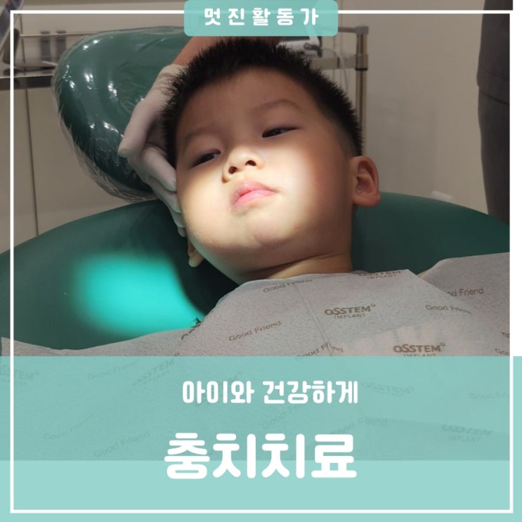 유아 치과치료 넘어져부러진 앞니 신경치료 대전 유성구 목원대근처 도안동 원신흥동 봄빛치과 두번째방문 유아 치과치료 넘어져부러진 앞니 신경치료 대전 유성구 목원대근처 도안동 원신흥동 봄빛치과 두번째방문