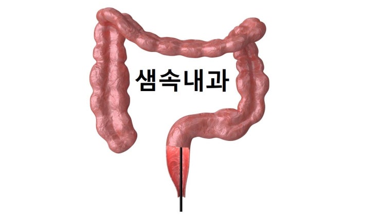  영천 국가건강검진 및 대장내시경은 어디서 하는게 좋을까요?