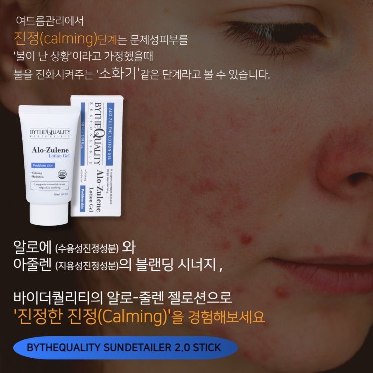  여드름, 아토피, 모낭염피부 알로줄렌 로션젤로 홈케어 끝!!