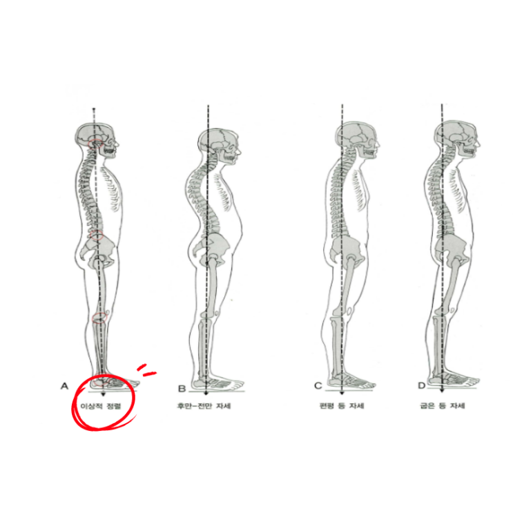  학생허리통증, 잘못된 자세를 벗어나는 방법