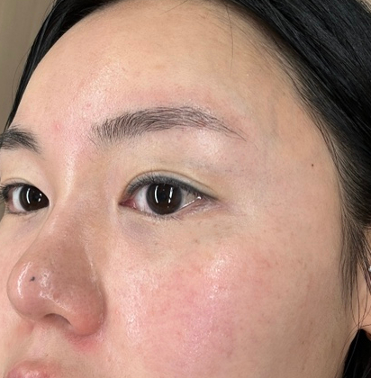  피부과에서 사용하는화장품, 에이유토닝 액티베이터