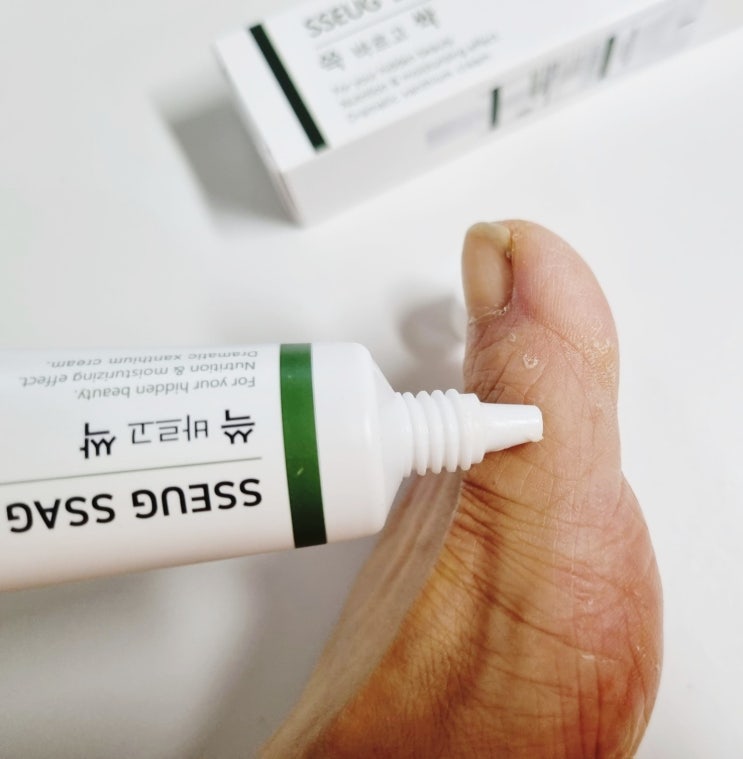  발등무좀 리버스풋 창이자 연고크림으로 문제성 발케어