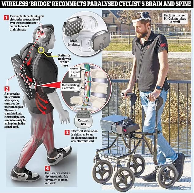 생각의 힘으로만 12년만에 걷게된 다리마비 남성 VIDEO: Incredible moment paralysed man walks for first time with implant