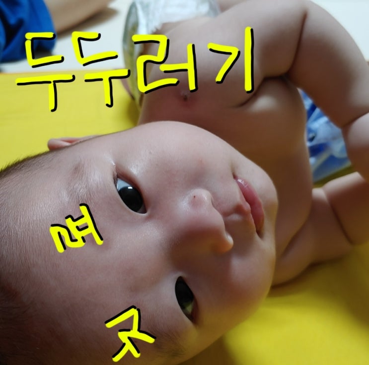  아기 두드러기 치료, 샤워후 발생한다면 2가지 사항 체크하세요.