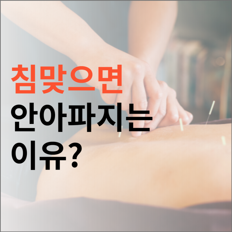 침맞으면 왜 통증이 줄어들까(feat 전침) 침맞으면 왜 통증이 줄어들까(feat 전침)