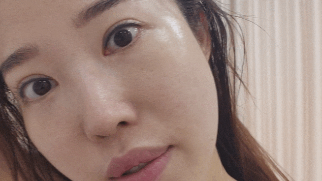  신림피부관리 리본에스테틱에서 물방울 리프팅 만족 후기