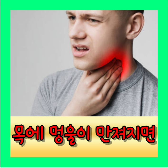 목 멍울 원인과 증상 그리고 오른쪽 왼쪽 가운데 혹 위치에 따른 질병과 치료방법