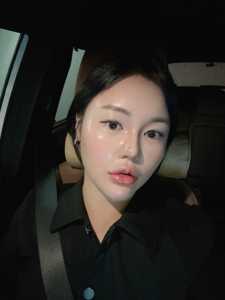  신사역피부과 벨로테로 입술필러 후기 (내돈내산)