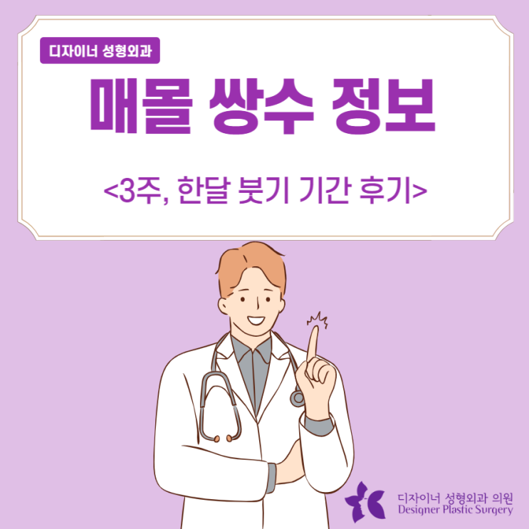  매몰 쌍수 정보 3주 1달 붓기 기간 후기