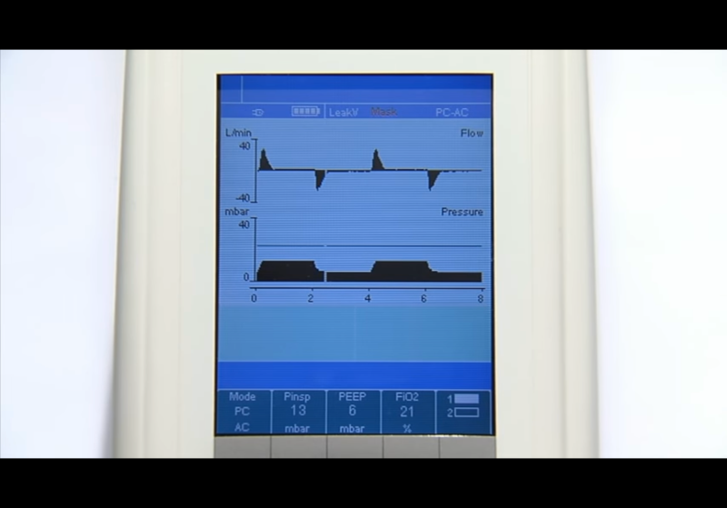 NIV) CPAP 와 BIPAP 비교하기 PEEP, IPAP, EPAP 공부하기 : 네이버 블로그