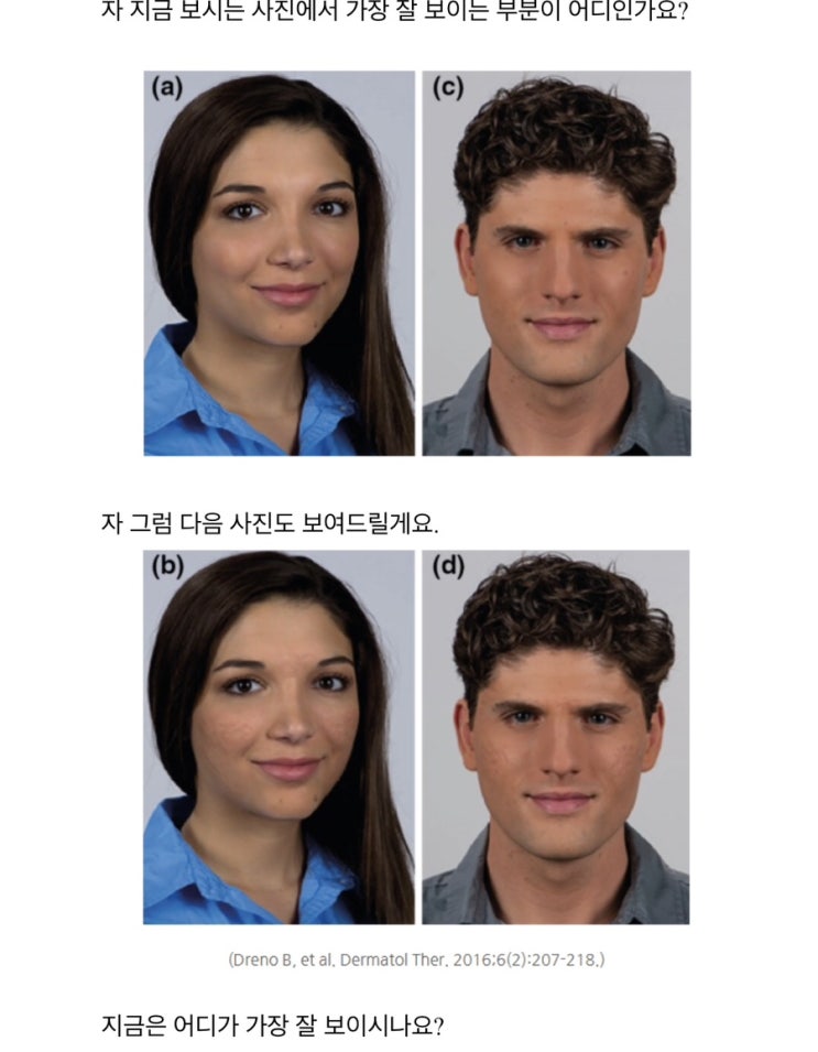 부산 해운대피부과 여드름 흉터 없애는 법 부산 해운대피부과 여드름 흉터 없애는 법