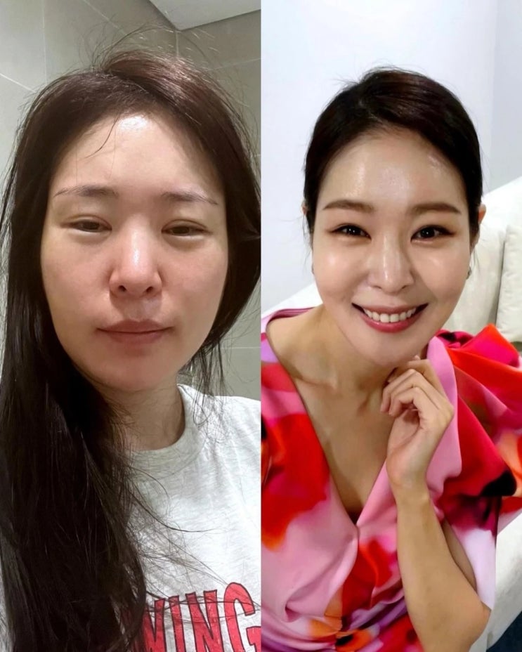 "완전 딴 사람" 미자, 퉁퉁 부은 얼굴 과감히 투척한 미녀 개그우먼 "완전 딴 사람" 미자, 퉁퉁 부은 얼굴 과감히 투척한 미녀 개그우먼