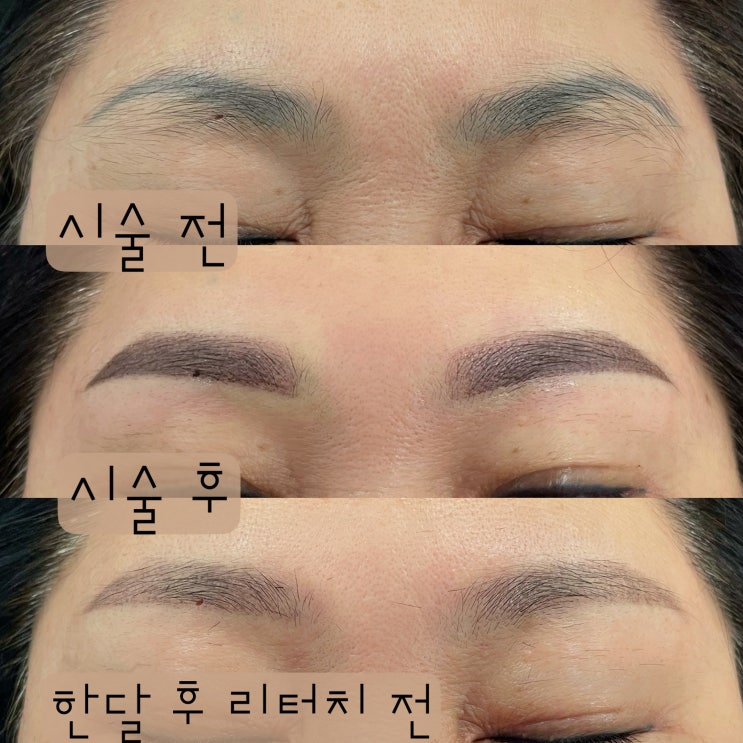 소비자는 모르는 천안 눈썹 문신의 진실 소비자는 모르는 천안 눈썹 문신의 진실