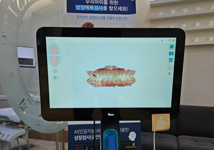 투명교정 인비절라인 진단과정과 장점에 대해 알려드립니다. 투명교정 인비절라인 진단과정과 장점에 대해 알려드립니다.