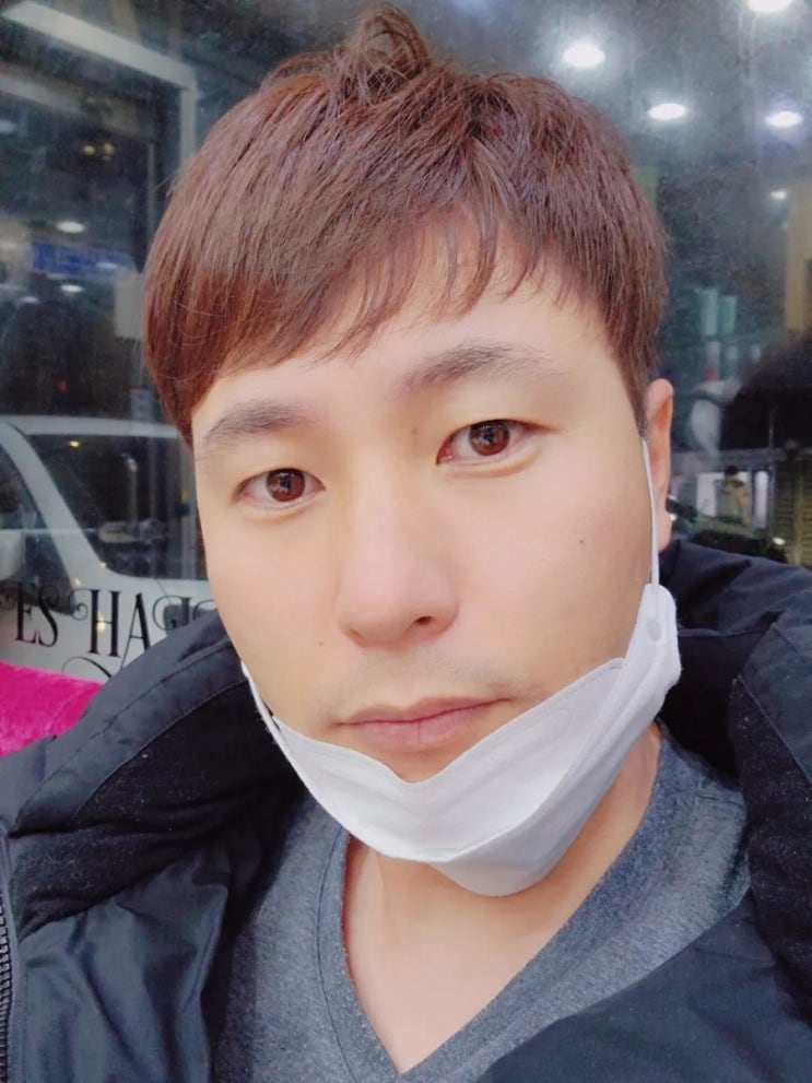  점빼는비용 개당 100원 ㅋㅋ, 남자수염제모 4회차, 얼굴점빼기 2회차 실제후기(내돈내산)