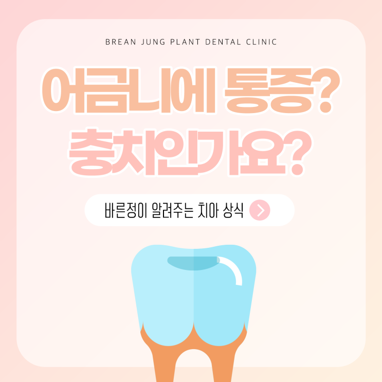  덕천치과 어금니 통증 설마 충치일까요?