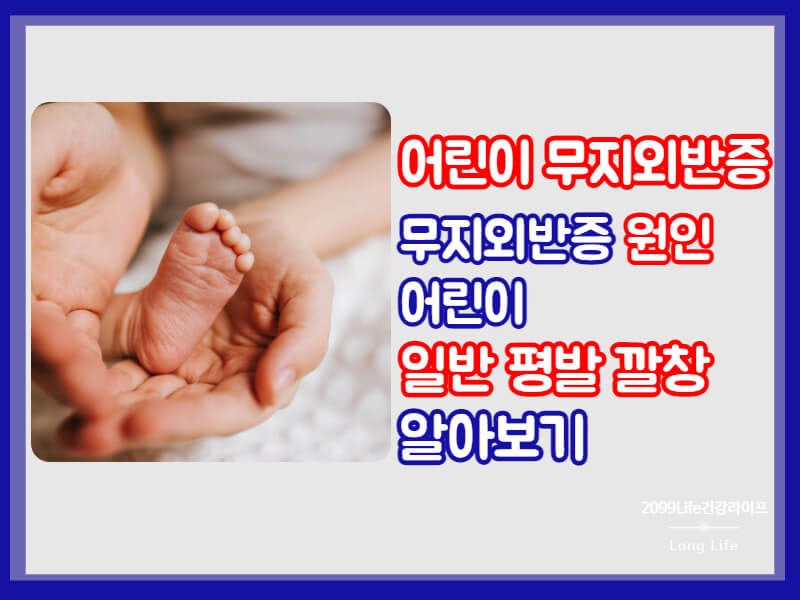 어린이 무지외반증 원인 어린이 평발 깔창 중요한 이유
