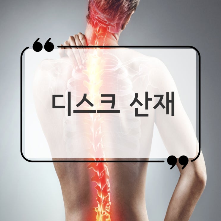  디스크 산재, 허리 요추 추간판탈출증 승인을 원하신다면