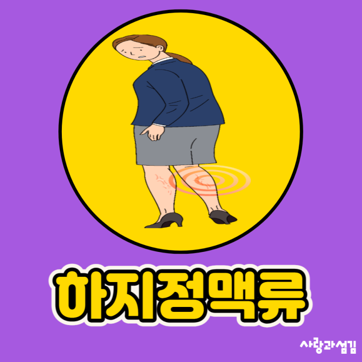 하지정맥류 원인 초기증상 통증 수술 치료 알아보고 예방해요 하지정맥류 원인 초기증상 통증 수술 치료 알아보고 예방해요