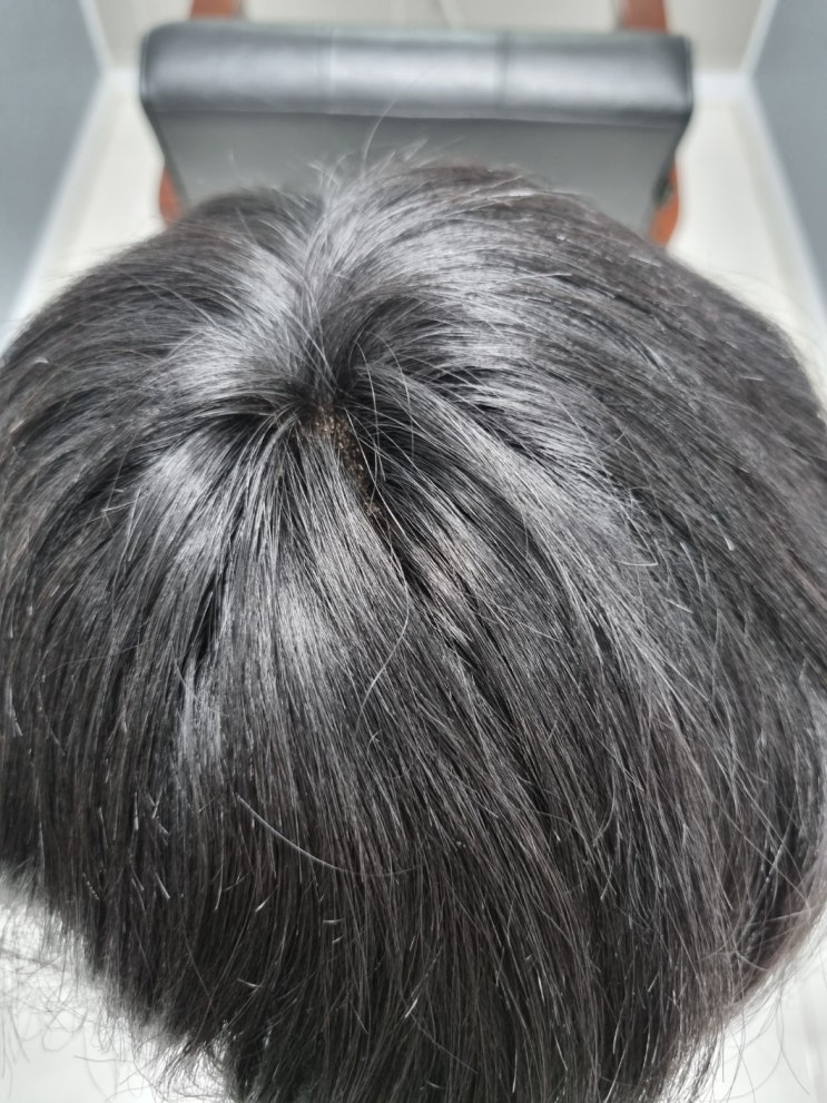  대구맞춤가발 :: 두피커버 자연스러운 해솔가모