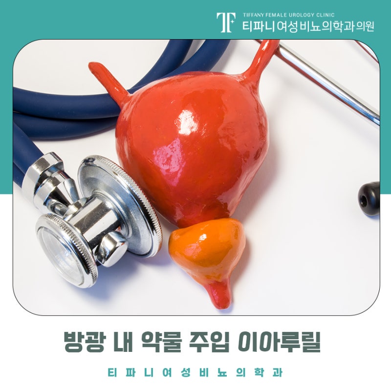 논현동 여성 비뇨기과 방광에 약물을 주입하는 이유
