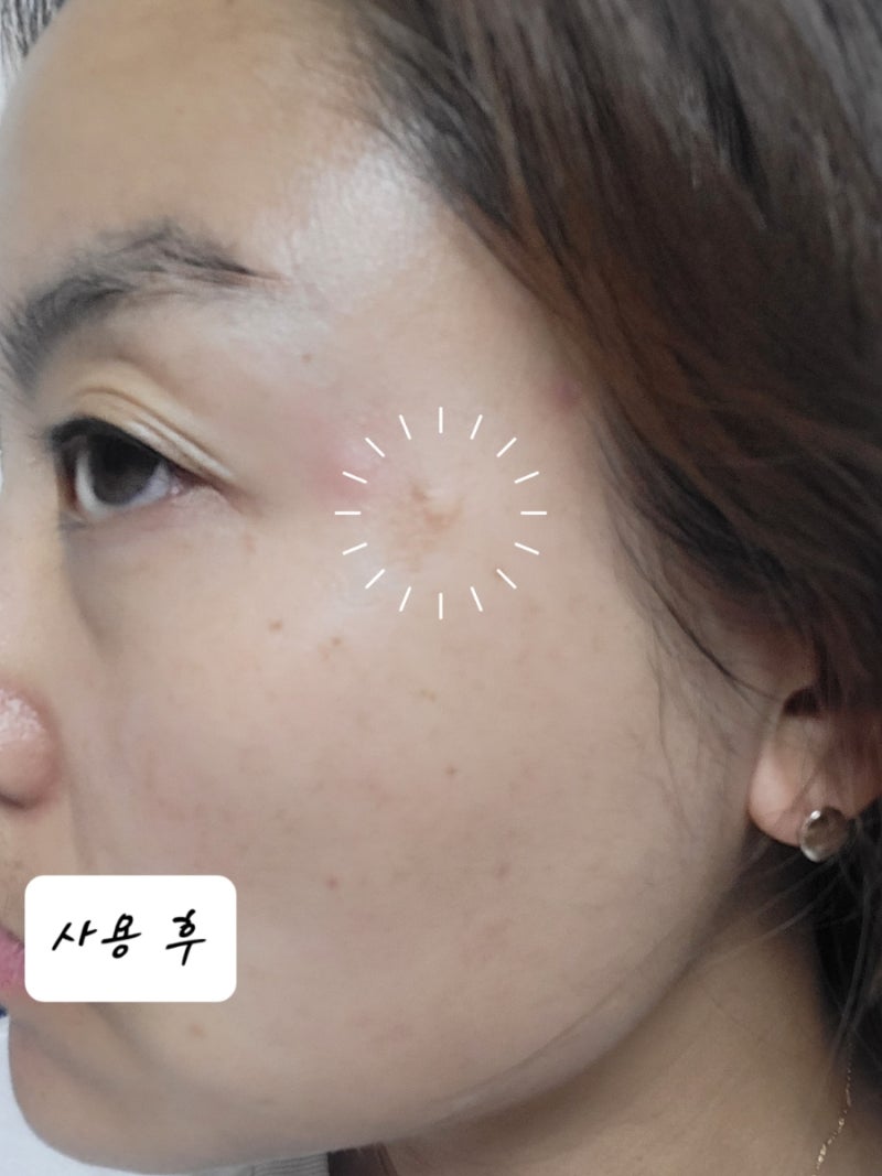 약국기미크림 들깨가루가 들어있는 자연주의 마미레시피 미미크림 : 네이버 블로그