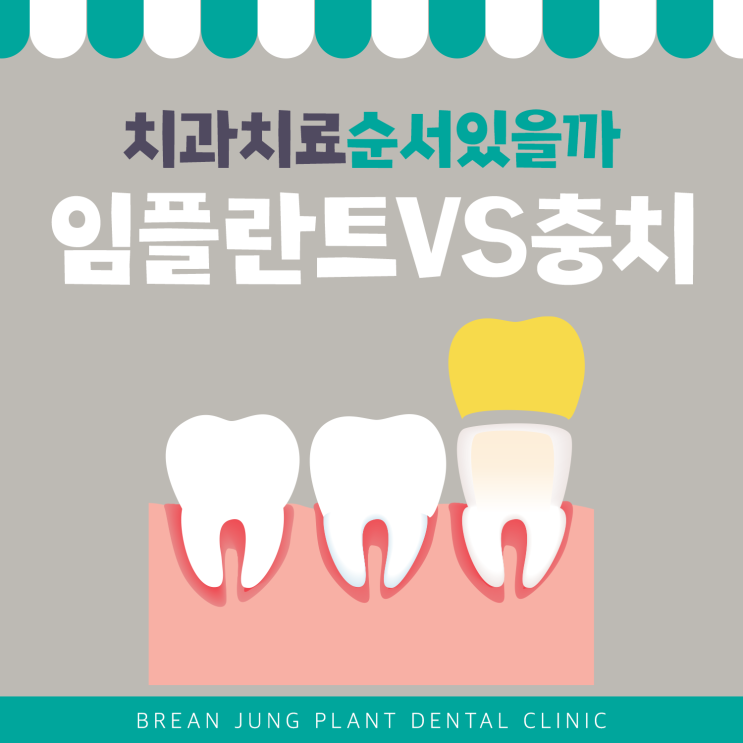  화명동치과 충치치료 먼저?임플란트 먼저?