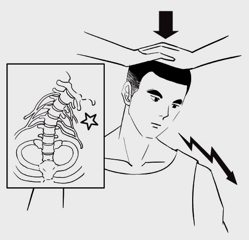  수성구 정형외과 목디스크 자가 진단하는 방법