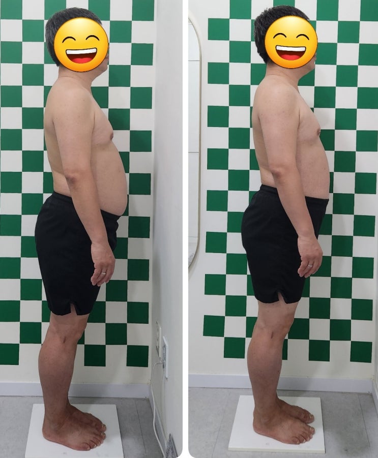  슬리밍고 체형교정 다이어트 프로그램 하루만에 변화(30대 여성, 40대 남자 교수님)