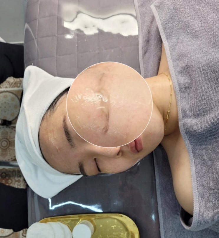  광주 첨단 피부관리실 밀라뷰티 스킨플래닝 후기