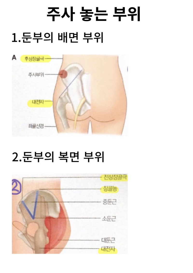 초보자 주사위치 안내