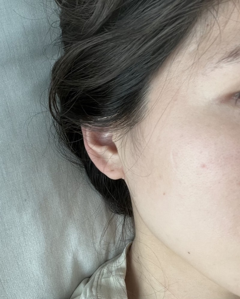 결혼 전 관리 내돈내산 백옥주사 (글루타치온 주사) 10번 맞은 솔직후기