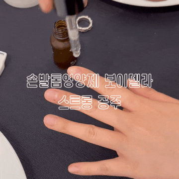  손톱영양제 보이델라 손톱갈라짐 관리에 좋은 손발톱영양제 추천