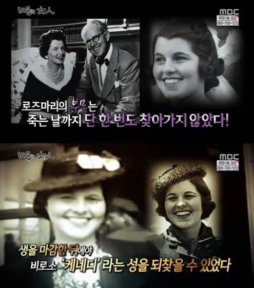 존 F. 케네디의 동생 강제로 받았던 전두엽 파괴술
