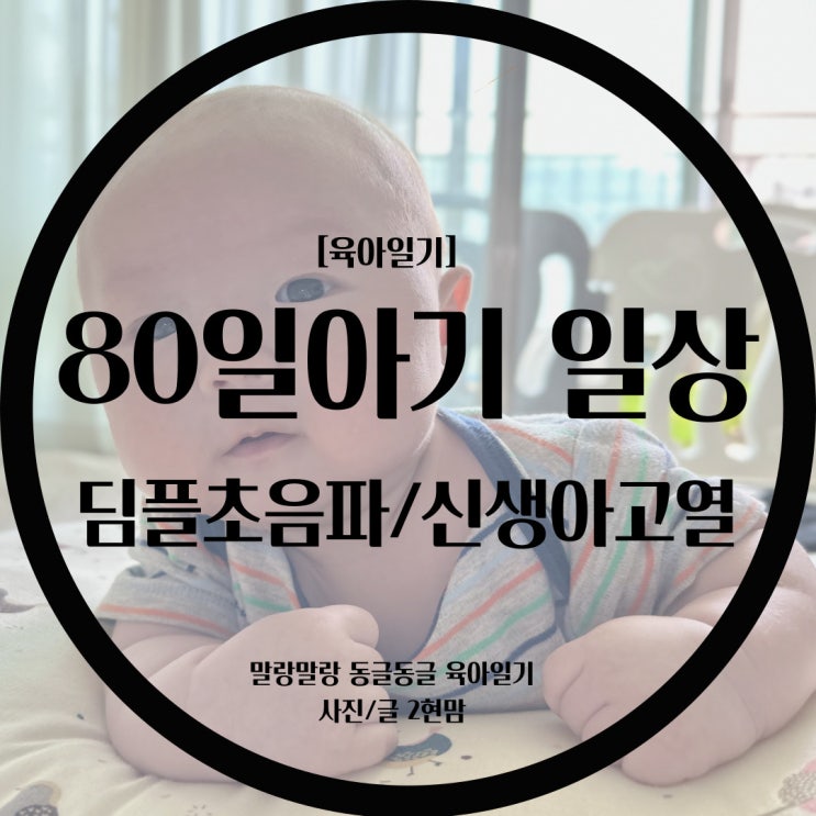  [육아일기] 세현이의 80일 (딤플초음파/신생아열/분태기/먹태기/통잠은 언제잘래?)