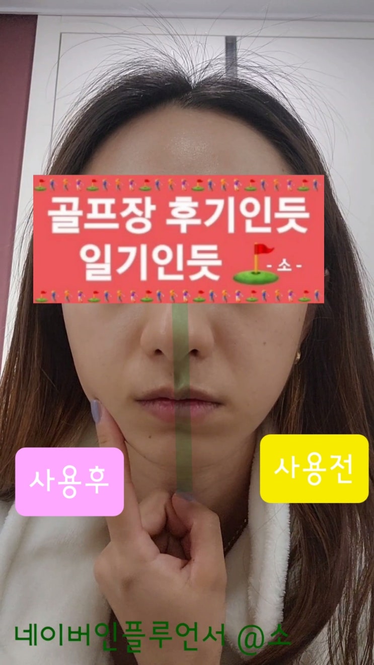  민감하고 예민해진 피부 저자극 장벽강화크림 추천 ( 아이보들 CCP 크림 )