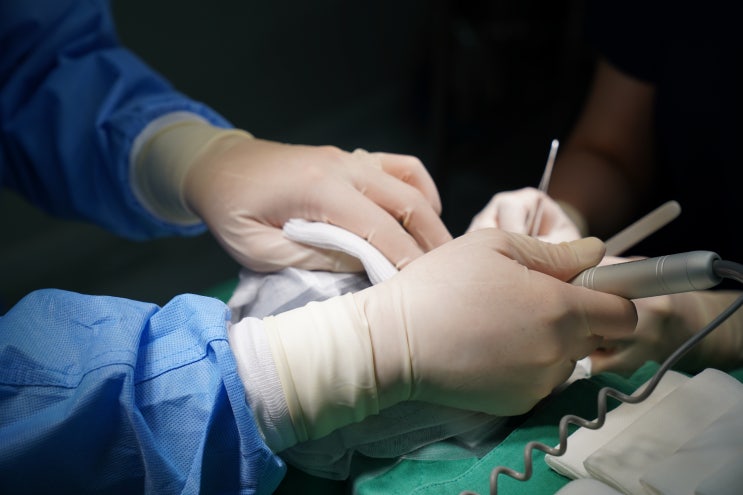 경주탈모 모발이식 생착률높일수있는 병원 추천
