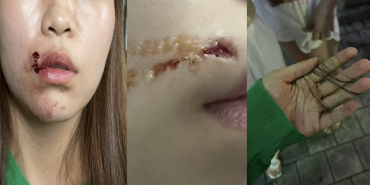 ‘대전판 <b>돌려차기</b> 사건’... <b>피해자</b> 아버지, <b>가해자</b> 엄벌... 